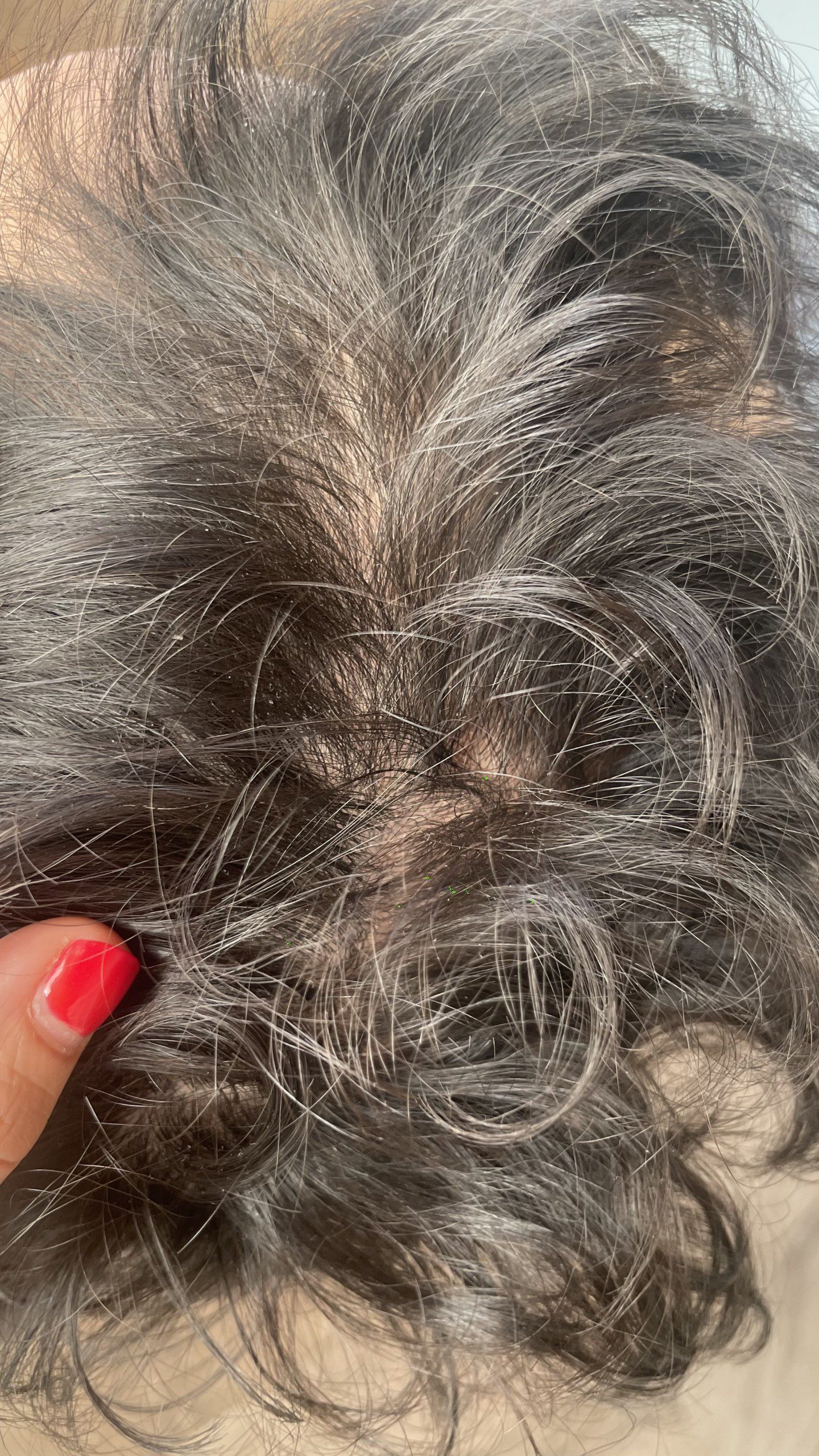 Después tratamiento alopecia Avec Belle